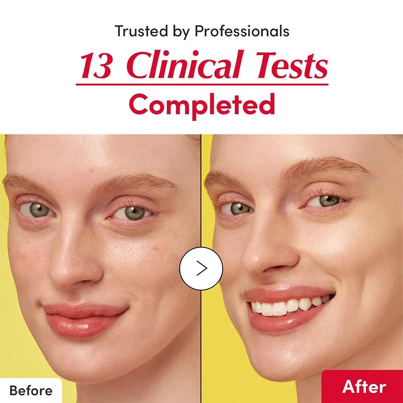 Deptora Korean Skincare Vitamin C Illuminating Serum - 40% Acerola Extract for Dark Spot Care
