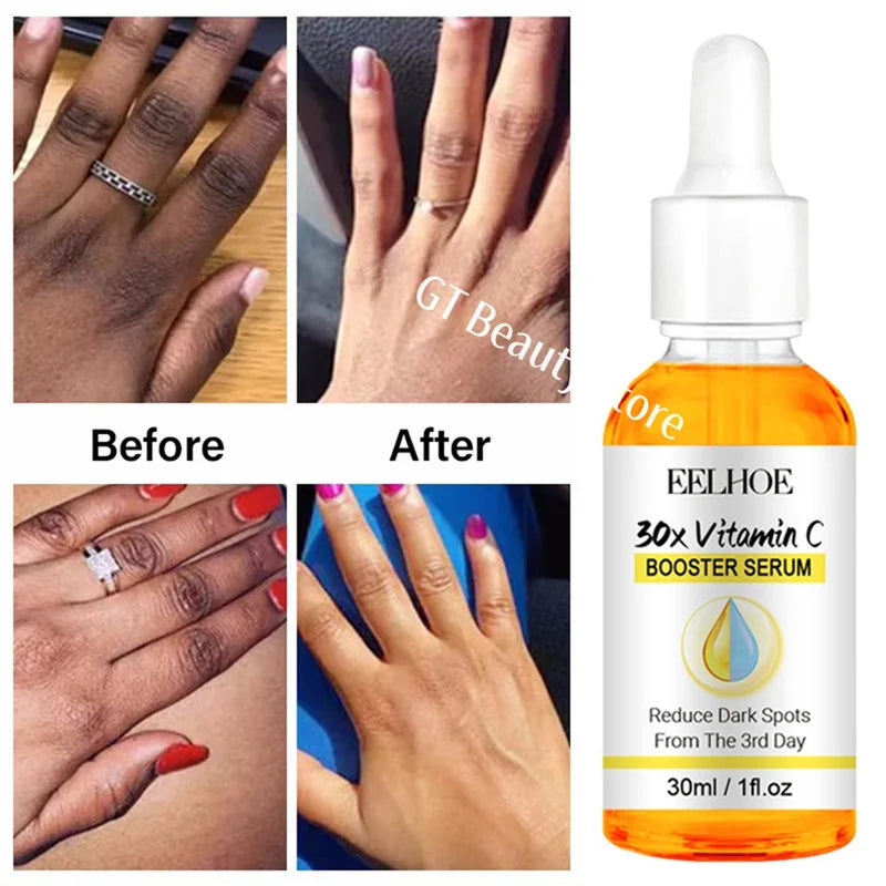 Dark Knuckles Fast Brighten Serum Elbows Hand Knuckle Brightening Serum Knee Black Skin Quickly Lighten Stains Remover Essence