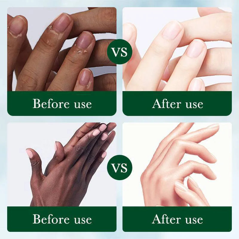 Fast Brighten Dark Knuckles Cream Whiting Hand Cream Lighten Melanin Stains Corrector Hand Anti Crack Soften Moisturize Product