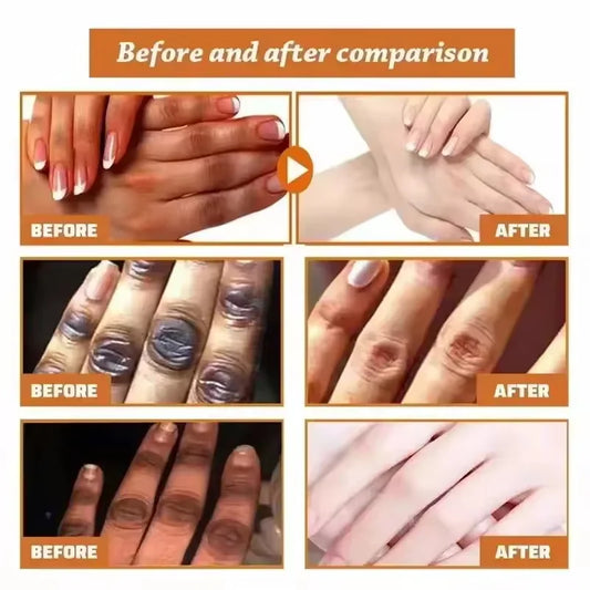 Dark Knuckles Fast Brighten Serum Elbows Hands Knee Armpits Brightening Serum Clarify Black Skin Lighten Stains Remover Essence