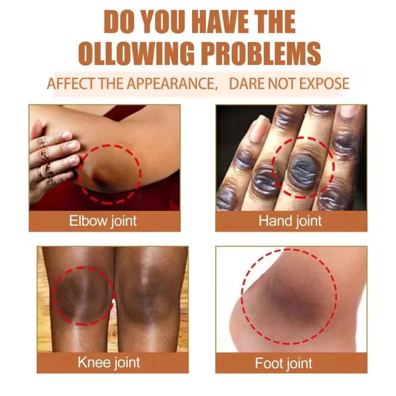 Dark Knuckles Fast Brighten Serum Elbows Hands Knee Armpits Brightening Serum Clarify Black Skin Lighten Stains Remover Essence