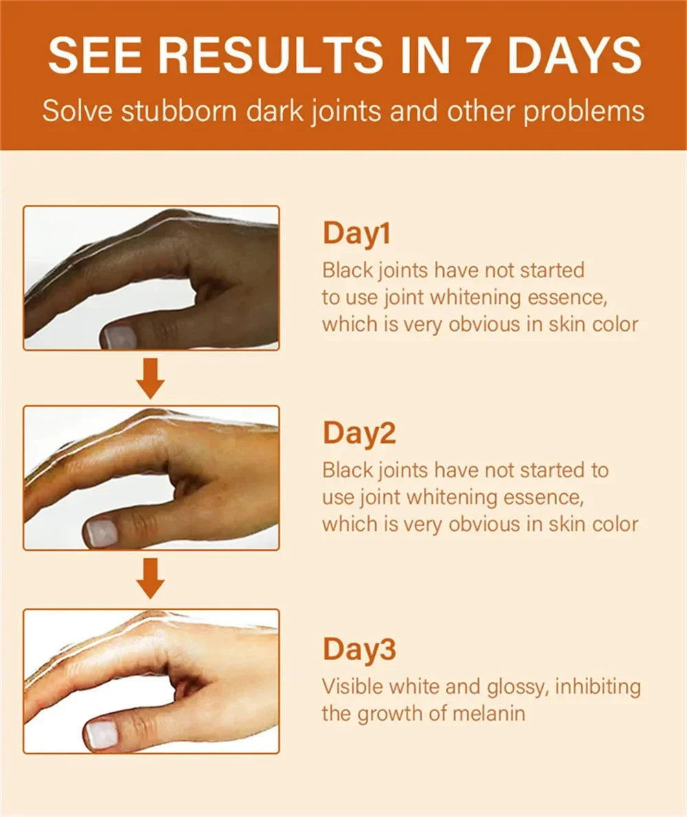 Dark Knuckles Fast Brighten Serum Elbows Hands Knee Armpits Brightening Serum Clarify Black Skin Lighten Stains Remover Essence