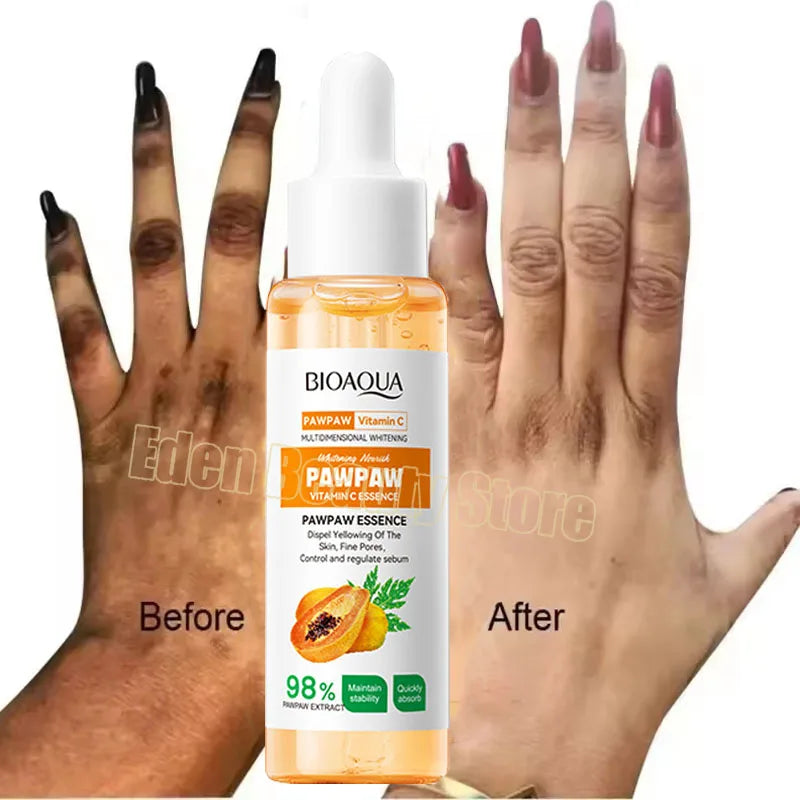 Dark Knuckles Fast Brighten Serum Elbows Hands Knee Armpits Brightening Serum Clarify Black Skin Lighten Stains Remover Essence